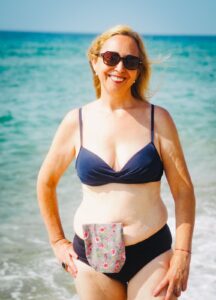 Ostomia y verano